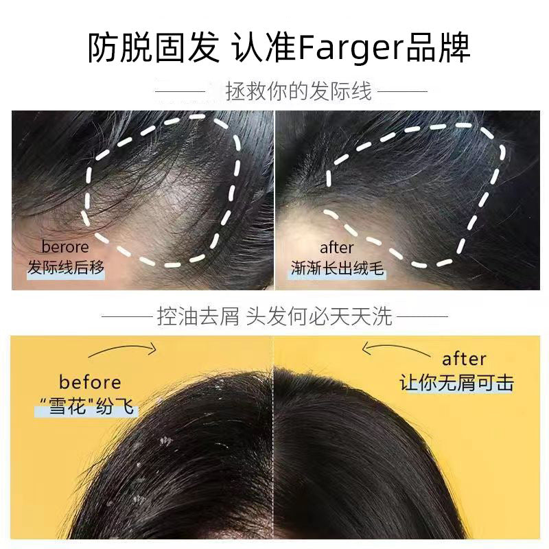 Farger Fage Anti-Hair Loss Firming Shampoo with Ginger and Platycladus Leaves, Oil Control, Strengthening, Anti-Hair Loss Hair Wash Cream, Shampoo